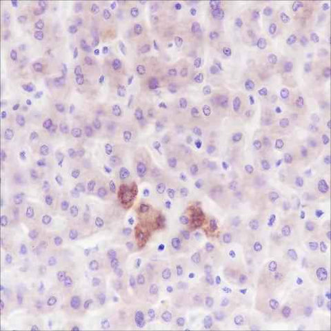 Anti-Human/Mouse PDK1 Antibody [A325] - ABMIUM