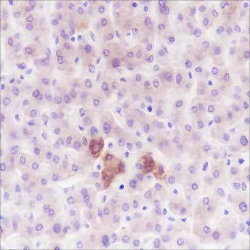 Anti-Human/Mouse PDK1 Antibody [A325] - ABMIUM