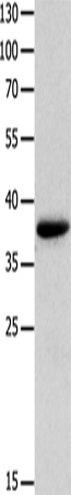 Anti-Human/Mouse MYOZ1 Antibody - ABMIUM