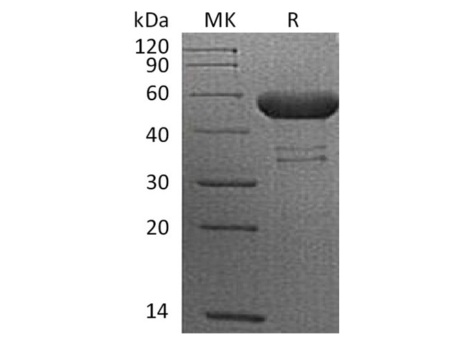Recombinant Cynomolgus CTLA-4/CD152 Protein (Fc Tag) - ABMIUM
