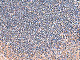 Immunohistochemistry of paraffin-embedded Human tonsil tissue using ZNF256 Polyclonal Antibody at dilution of 1:70(×200)