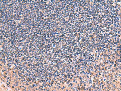 Immunohistochemistry of paraffin-embedded Human tonsil tissue using ZNF256 Polyclonal Antibody at dilution of 1:70(×200)