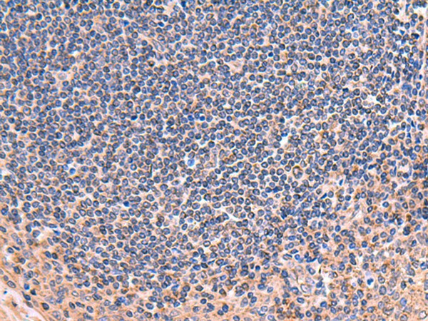Immunohistochemistry of paraffin-embedded Human tonsil tissue using ZNF256 Polyclonal Antibody at dilution of 1:70(×200)