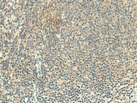 Immunohistochemistry of paraffin-embedded Human tonsil tissue using ALPK1 Polyclonal Antibody at dilution of 1:50(×200)