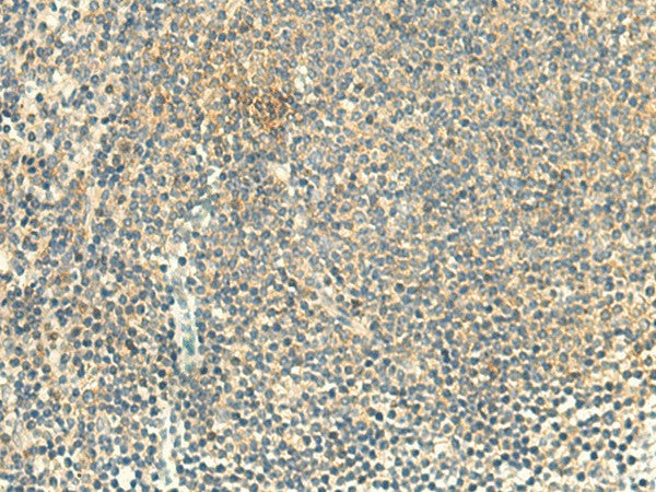 Immunohistochemistry of paraffin-embedded Human tonsil tissue using ALPK1 Polyclonal Antibody at dilution of 1:50(×200)