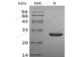 Recombinant Human HO-1/HMOX1 Protein - ABMIUM