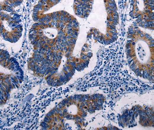 Anti-Human/Mouse/Rat DUSP6 Antibody