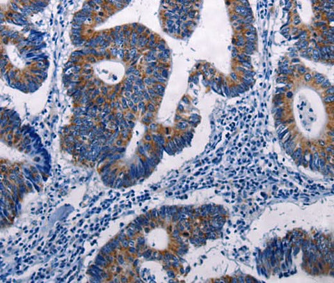Anti-Human/Mouse/Rat DUSP6 Antibody - ABMIUM