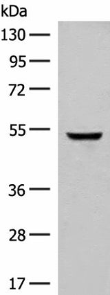 Anti-Human/Mouse GLCCI1 Antibody - ABMIUM
