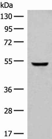 Anti-Human/Mouse GLCCI1 Antibody