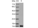 Recombinant Mouse Galectin-1/LGALS1 Protein - ABMIUM