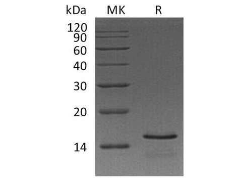 Recombinant Human Natriuretic Peptides B/NPPB Protein (His Tag) - ABMIUM