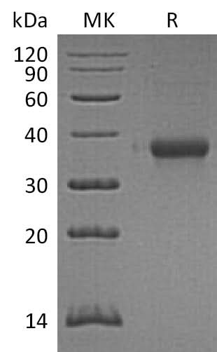 Recombinant Mouse IMPAD1/IMP3 Protein (His Tag) - ABMIUM