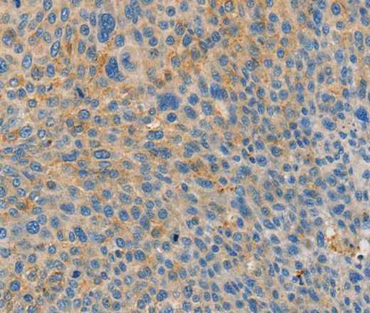 Anti-Human BRCA1 Antibody