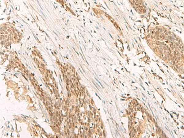 Anti-Human/Mouse/Rat POP4 Antibody
