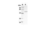 SDS-PAGE analysis of Human PTEN MMAC1 TEP1 proteins , 2 μg/lane of Recombinant Human PTEN MMAC1 TEP1 proteins was resolved with SDS-PAGE under reducing conditions , showing bands at 45 kDa.