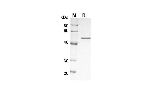 SDS-PAGE analysis of Human PTEN MMAC1 TEP1 proteins , 2 μg/lane of Recombinant Human PTEN MMAC1 TEP1 proteins was resolved with SDS-PAGE under reducing conditions , showing bands at 45 kDa.