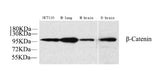 Western Blot analysis of various samples using Catenin beta Polyclonal Antibody at dilution of 1:1000.