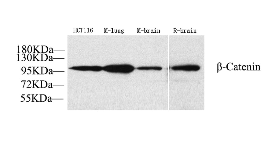 Western Blot analysis of various samples using Catenin beta Polyclonal Antibody at dilution of 1:1000.