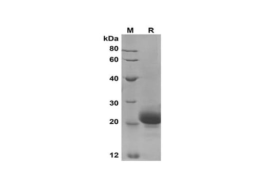 SDS-PAGE analysis of Human TNFRSF12A proteins,2 μg/lane of Recombinant Human TNFRSF12A proteins,was resolved with SDS-PAGE under reducing conditions,showing bands at 21 kDa.