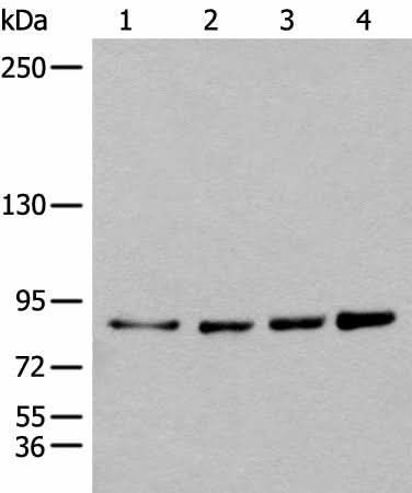 Anti-Human PIBF1 Antibody - ABMIUM