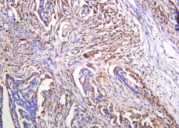 Anti-Human/Mouse/Rat Galectin-3 Antibody [B950] - ABMIUM