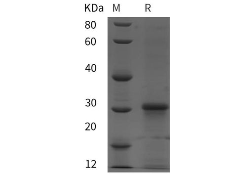 SDS-PAGE analysis of Mouse ACTH proteins, 2 μg/lane of Recombinant Mouse ACTH proteins was resolved with SDS-PAGE under reducing conditions, showing bands at 30 kDa.
