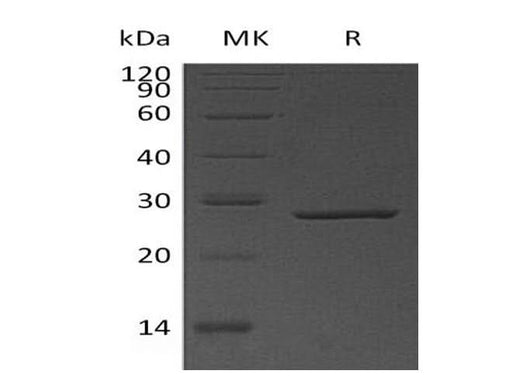 Recombinant Human Thymidylate Kinase/DTYMK Protein (His Tag) - ABMIUM