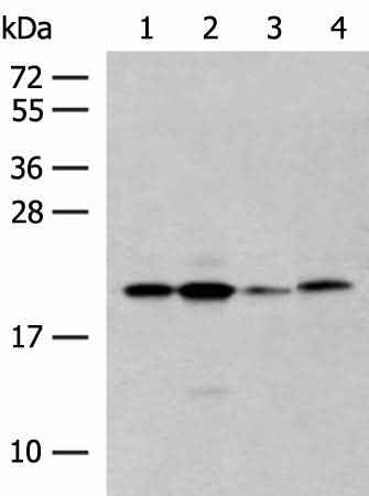 Anti-Human/Mouse/Rat RNF5 Antibody