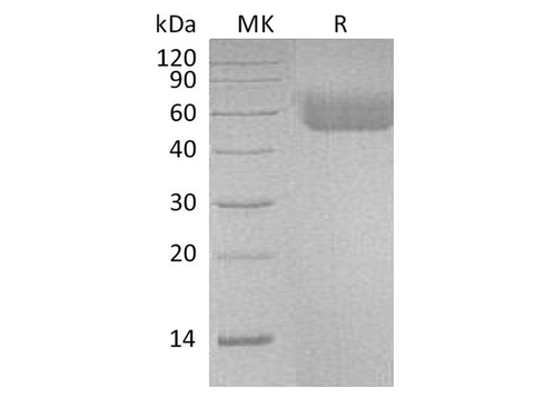 Recombinant Human IL1R1/CD121a Protein (His Tag) - ABMIUM