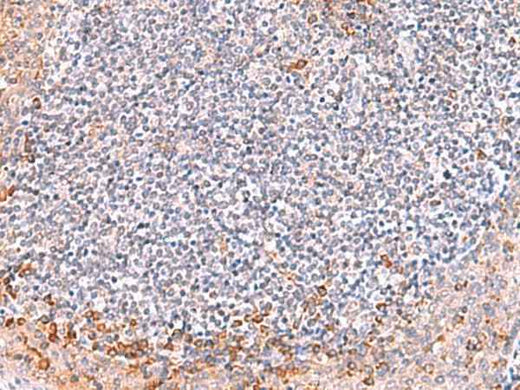 Anti-Human/Mouse ITSN2 Antibody
