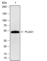 Anti-Human/Rat/Mouse PLAG1 Antibody [A660]