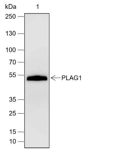 Anti-Human/Rat/Mouse PLAG1 Antibody [A660]
