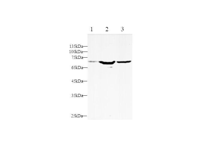 Anti-Human KIM-1 Antibody - ABMIUM
