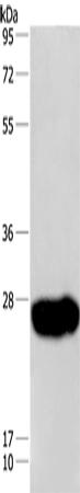 Anti-Human CAV3 Antibody - ABMIUM