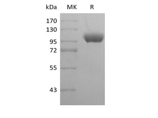 Recombinant Human Leukocyte Ig-Like Receptor B1/ LILRB1/ILT2/CD85j (C-Fc) - ABMIUM