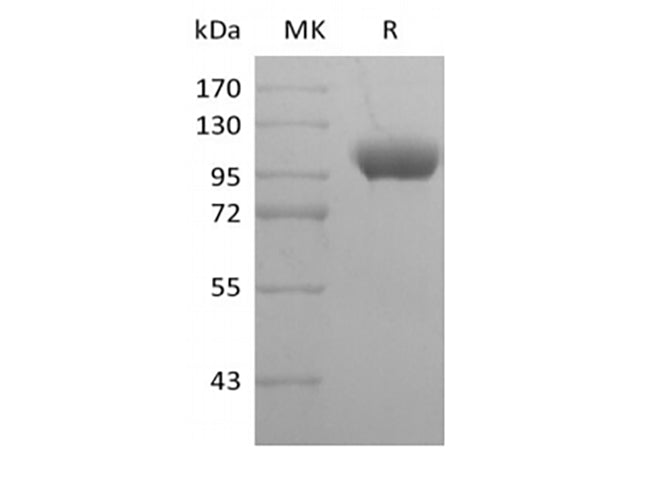 Recombinant Human Leukocyte Ig-Like Receptor B1/ LILRB1/ILT2/CD85j (C-Fc) - ABMIUM