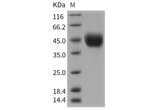 Recombinant Rat CD14 Protein (His Tag) - ABMIUM