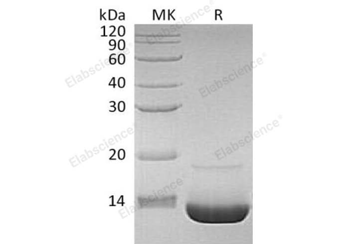 Recombinant Human Complement Component C3a/C3a Protein - ABMIUM