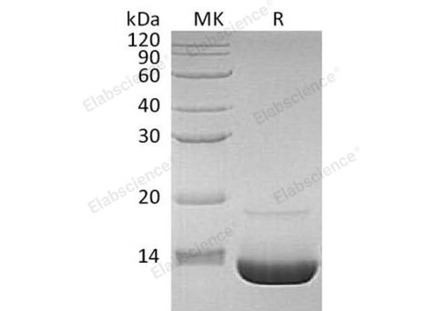 Recombinant Human Complement Component C3a/C3a Protein - ABMIUM