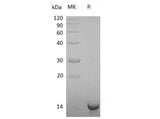 Recombinant Human Sulfotransferase/SULT1C4 Protein (His Tag) - ABMIUM