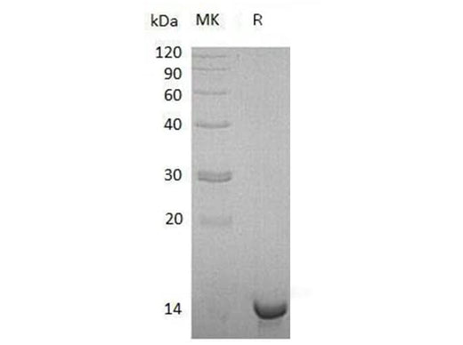 Recombinant Human Sulfotransferase/SULT1C4 Protein (His Tag) - ABMIUM