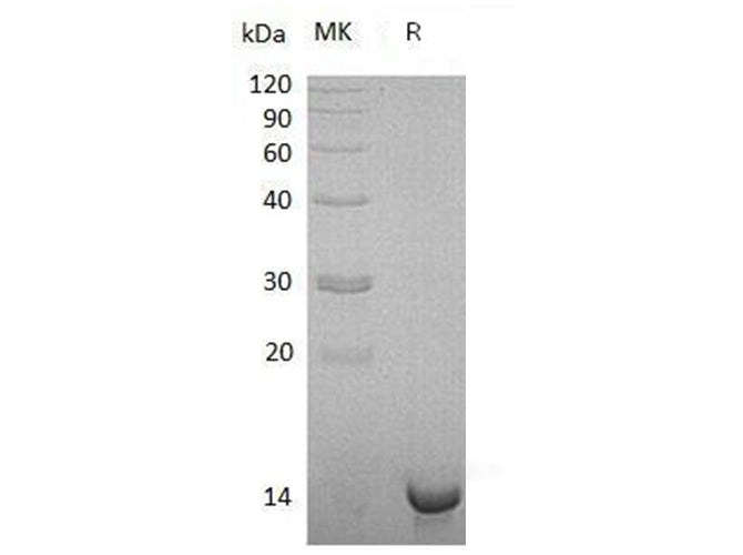 Recombinant Human Sulfotransferase/SULT1C4 Protein (His Tag) - ABMIUM