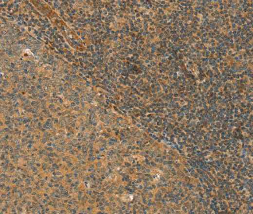 Anti-Human/Mouse/Rat CPA2 Antibody