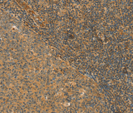 Anti-Human/Mouse/Rat CPA2 Antibody - ABMIUM