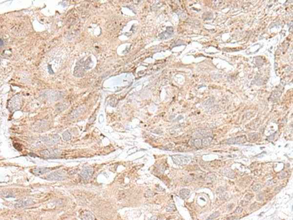 Anti-Human/Mouse SNRNP25 Antibody
