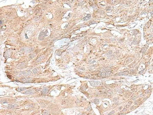 Anti-Human/Mouse SNRNP25 Antibody