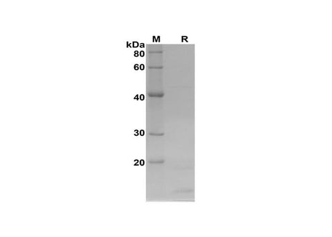 SDS-PAGE analysis of Rat Cytochrome c1 proteins, 2 μg/lane of Recombinant Rat Cytochrome c1 proteins was resolved with SDS-PAGE under reducing conditions, showing bands at 15 kDa.