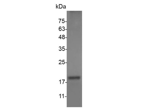Recombinant Mouse FasL protein(His Tag) - ABMIUM