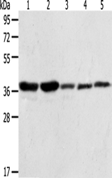Anti-Human/Mouse/Rat ANXA1 Antibody - ABMIUM